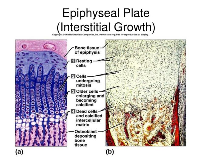 Art-ranking activity growth at the epiphyseal plate