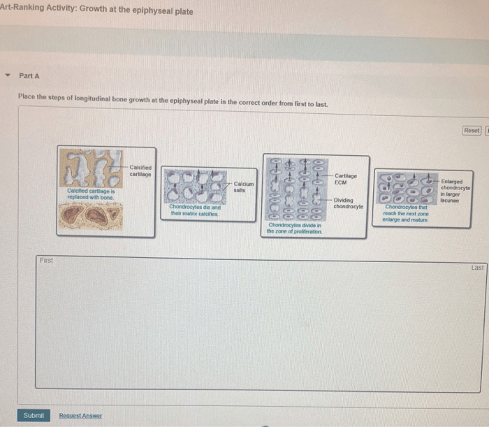 Art-ranking activity growth at the epiphyseal plate